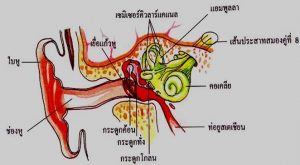 โรค หินปูนเกาะกระดูกหู (otosclerosis)