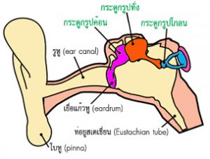 โรค หินปูนเกาะกระดูกหู (otosclerosis)