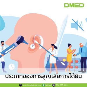 ประเภทของการสูญเสียการได้ยิน